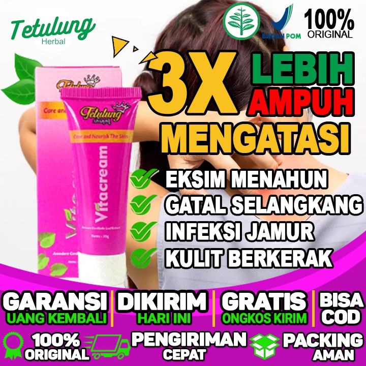Krim Untuk Kulit Gatal Dan Kering Salep Cream Untuk Gatal Di bagian leher Dijamin Ampuh