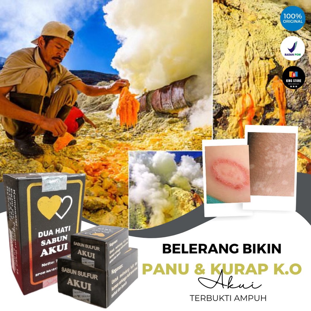 Sabun Belerang  Obat Panu Paling Ampuh 100 - Sabun Jamur Kulit Kutu Air Penghilang Bekas Luka - Sabu