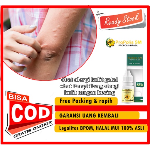 Propolis SM - obat alergi kulit gatal, obat Penghilang alergi kulit tangan kering, obat alergi kulit