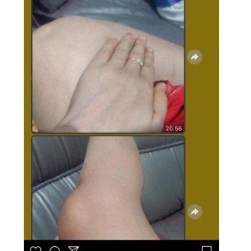 hb forte plus dr widyarini