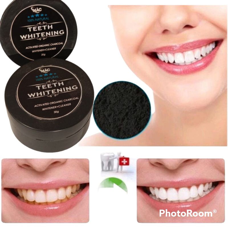 Pemutih Gigi Permanen Asli Viral,Teeth Whitening chorcoal charcoal original/obat perontok Karang Gigi