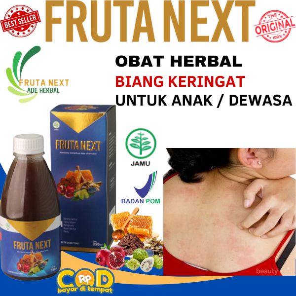 FRUTANEXT Obat Biang Keringat Penghilang Ruam Gatal Biang KeringatAnak dan Dewasa Tanpa Efek Samping