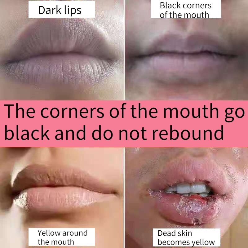 Masker bibir Pemerah bibir Lip balm 10g Tak ada efek samping mencerahkan warna bibir Singkirkan bibir kering dan pecah Kecilkan bibir kurangi ketebalan bibir  Ini bisa digunakan oleh pria, wanita dan wanita hamil