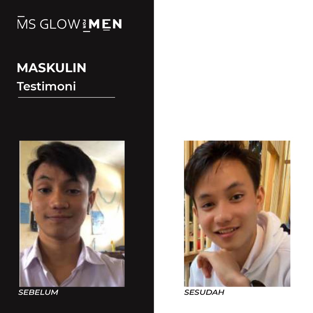 MS Glow For Men Skincare Cowok Original Maskulin by ms.glowofficiabandung