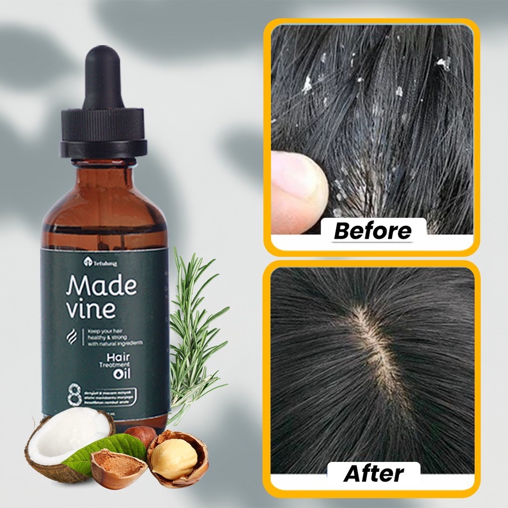 MADE VINE Penumbuh Rambut Botak - HAIR TREATMENT OIL 60ML SUDAH BPOM