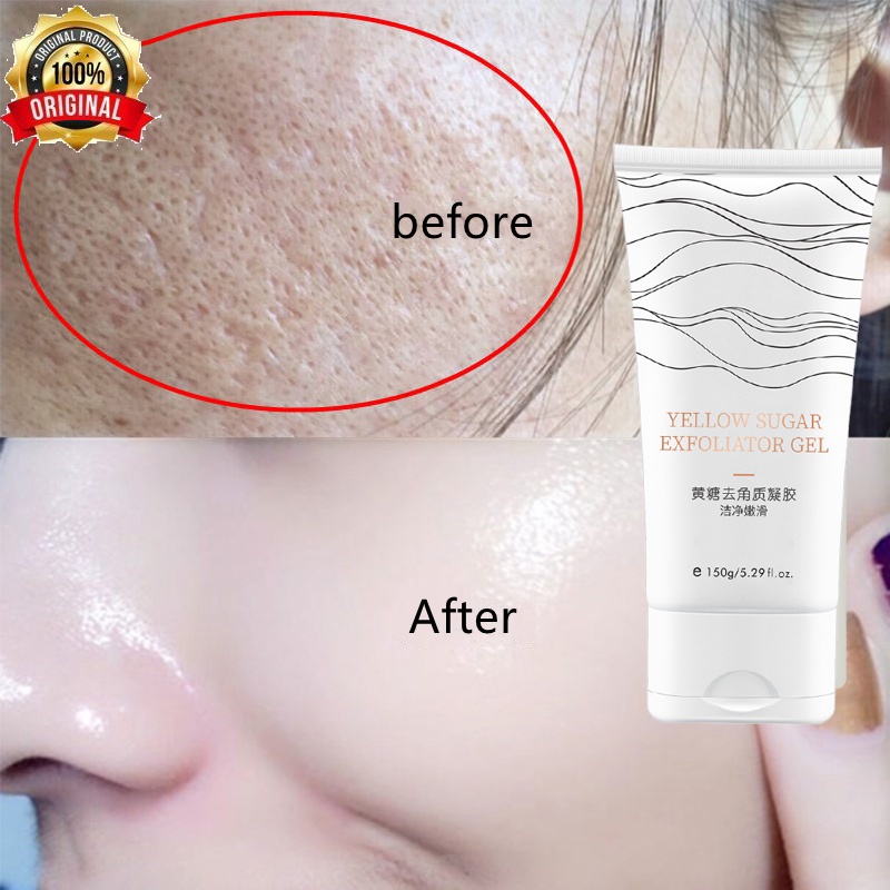 Jual eksfoliasi wajah Face Scrub Exfoliating Gel pembersih wajah Kapasitas ekstra besar 150gr