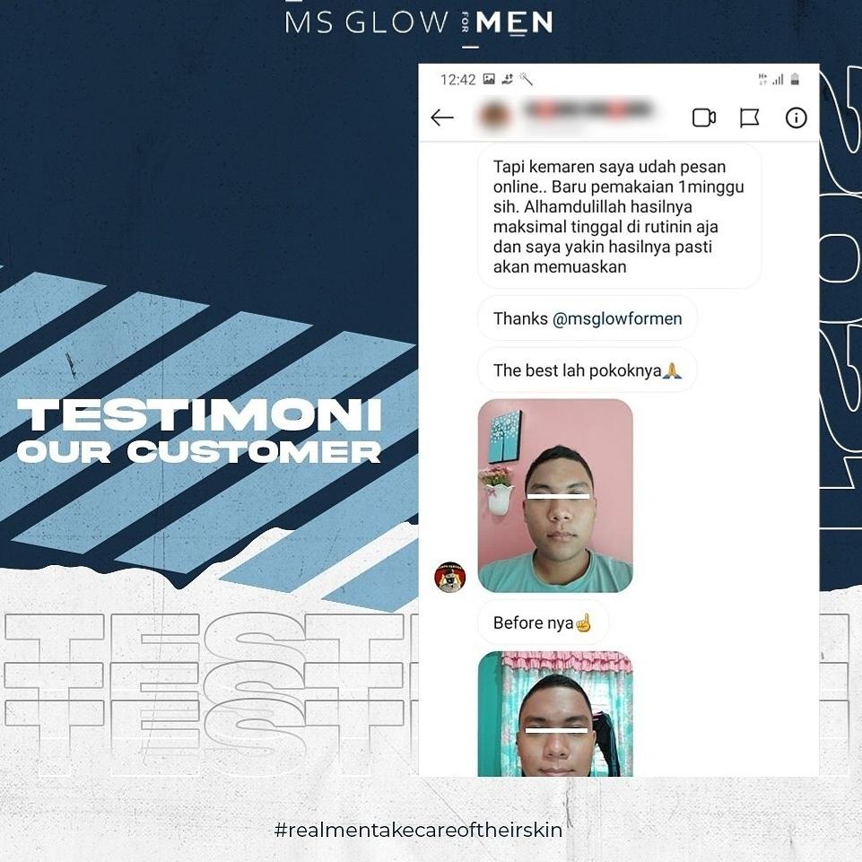 NEW ㅱ Ms Glow For Men Skincare Perawatan Wajah Pria Cowo Berminyak Kusam Jerawat Z♛