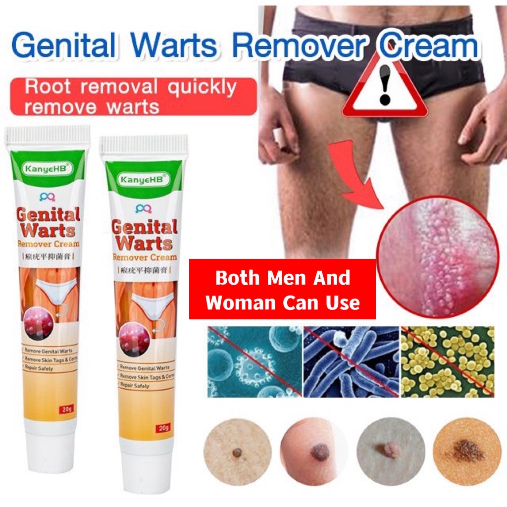 [Privasi Terjaga] Obat Kutil Kelamin Pria dan Wanita Obat Kutil Penghilang Salep Asli Obat Kutil Kelamin HPV Sipilis Gonore Kencing Nanah Raja Singa Kutil Di Anus Gatal Penis Bentol Bintik Merah Ruam Kulit Perih Lecet Herpes - Wart Remover 20g