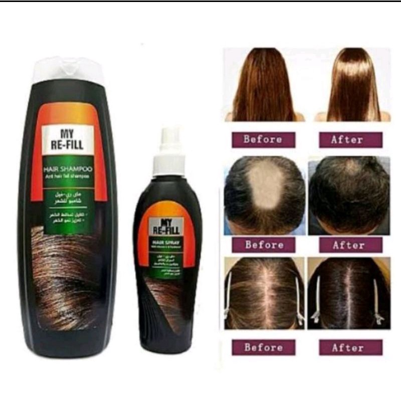 Shampoo Pria Wanita My Way Refill - Sampo Penumbuh Rambut Rontok