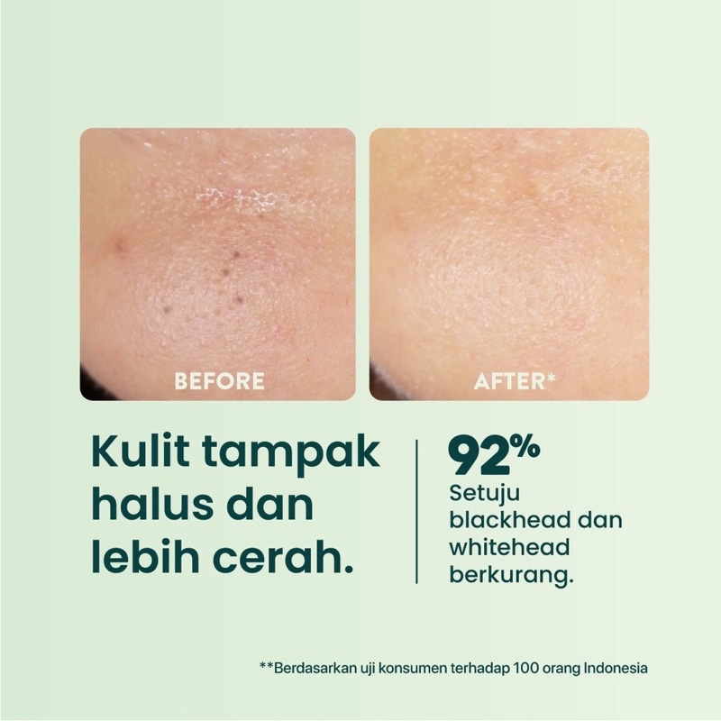 NPURE Cica Clear Pad / Kapas Eksfoliasi Wajah / Kapas untuk Mencerahkan &amp; Membersihkan Sel Kulit Mati