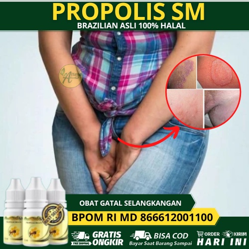 Obat Gatal Selakangan, Obat Selakangan Gatal Dan Hitam, Selangkangan Ruam, Menghitam,   Selangkangan