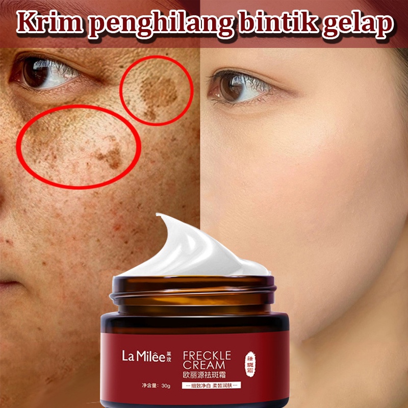 Krim bintik-bintik Krim penghilang bintik gelap Salep anti-bintik Meringankan melasma, bintik-bintik penuaan 30g Efektif menghilangkan flek hitam di wajah Krim pemutih wajah Cream whiteing Tidak melukai kulit