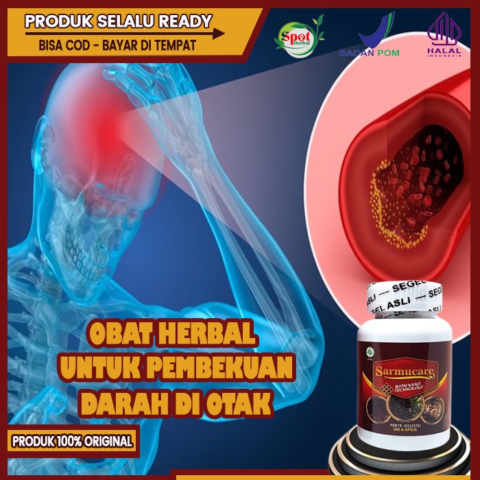 Jual Obat Herbal Pembekuan Darah Di Kepala Gumpalan Darah Beku Di Kepala Sarmucare Asli Obat 4029