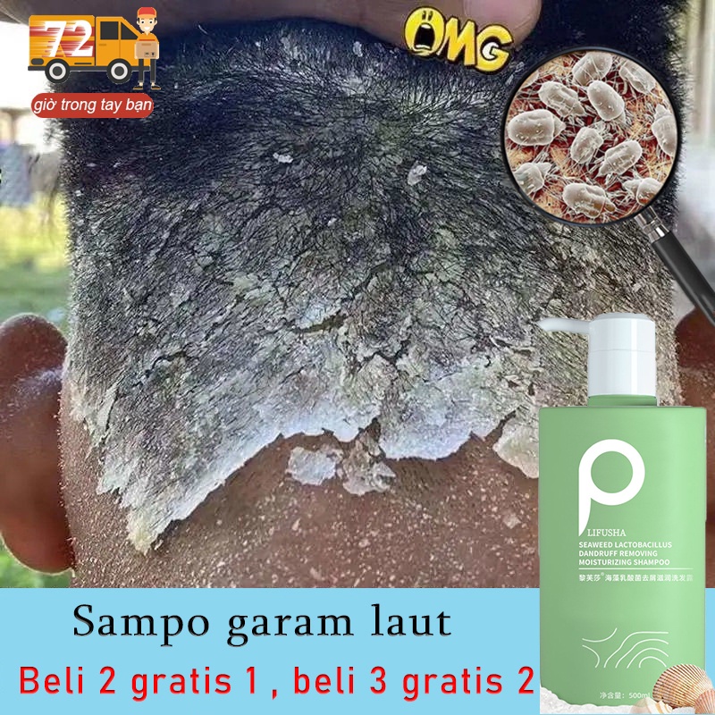 Jual Anti Dandruff Shampoo Sampo Anti Ketombe Shampo Anti Rontok Pengontrol Minyak Anti Gatal 8931