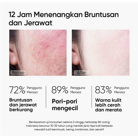 SKINTIFIC MUGWORT Anti Pores &amp; Acne Clay Mask
