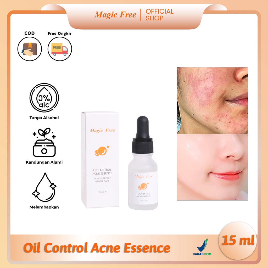 Jual Bpom Magic Free Oil Control Acne Essence Ml Membersihkan Mengontrol Minyak Pada