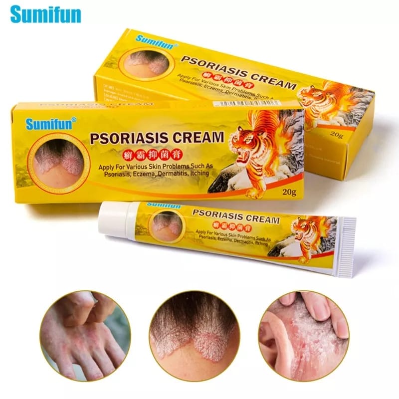 Salep Eksim Panu Gatal Dermatitis Jamur Kadas Kudis Pada Kulit Psoriasis Cream