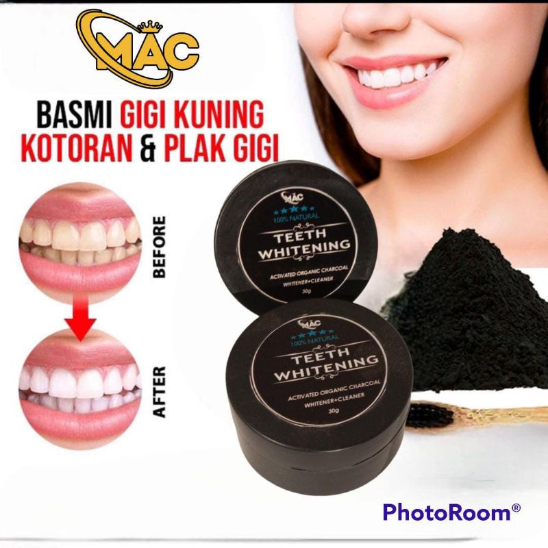 Pemutih Gigi Permanen Asli Viral,Teeth Whitening chorcoal charcoal original/obat perontok Karang Gigi