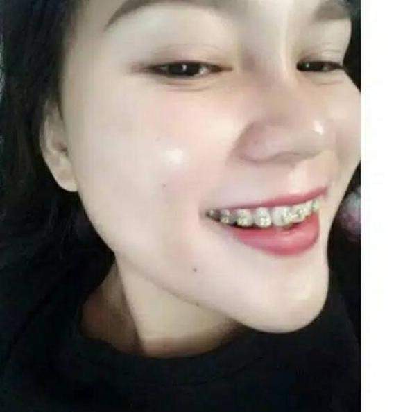 ㊤ Serum wajah Glowing kinclong Beauty glow farma Ori TERLARIS 2696 ✿