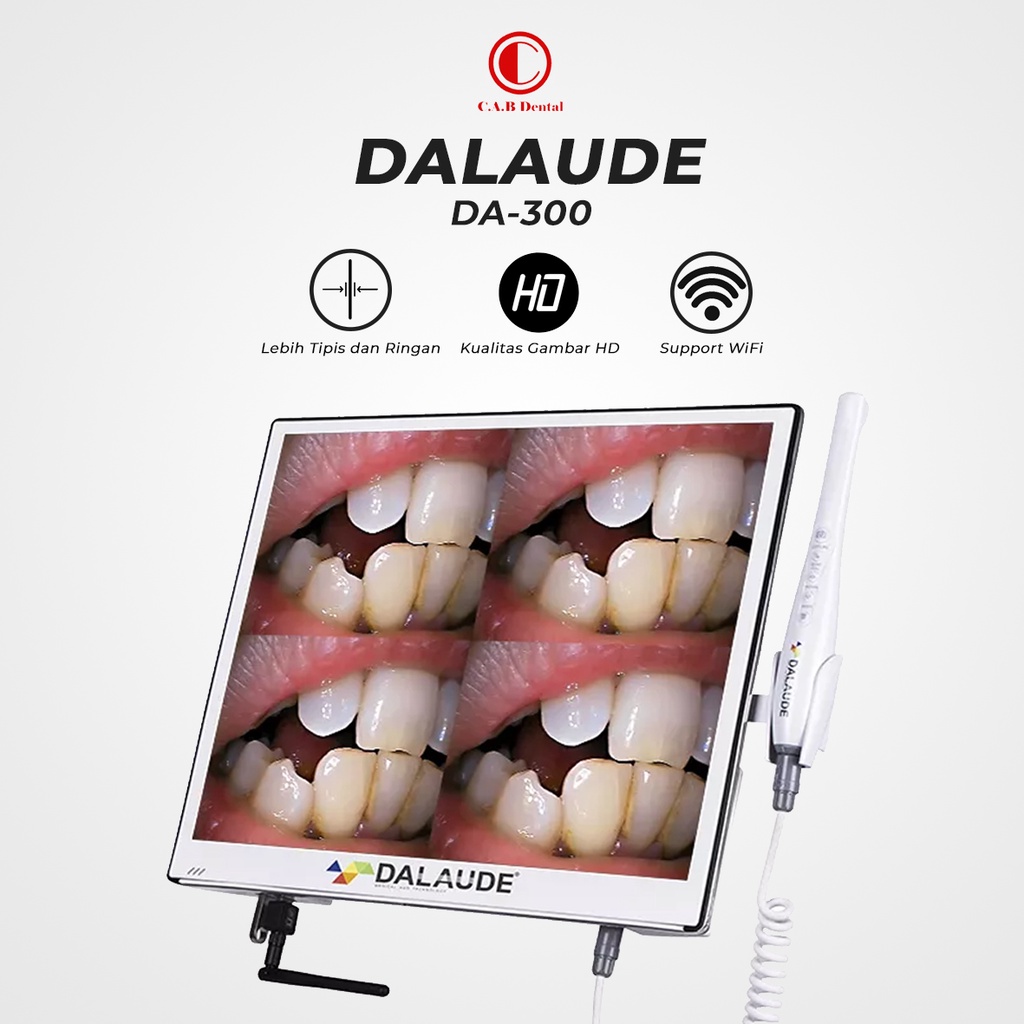 INTRA ORAL CAMERA DALAUDE DA-300 / IOC DALAUDE 300