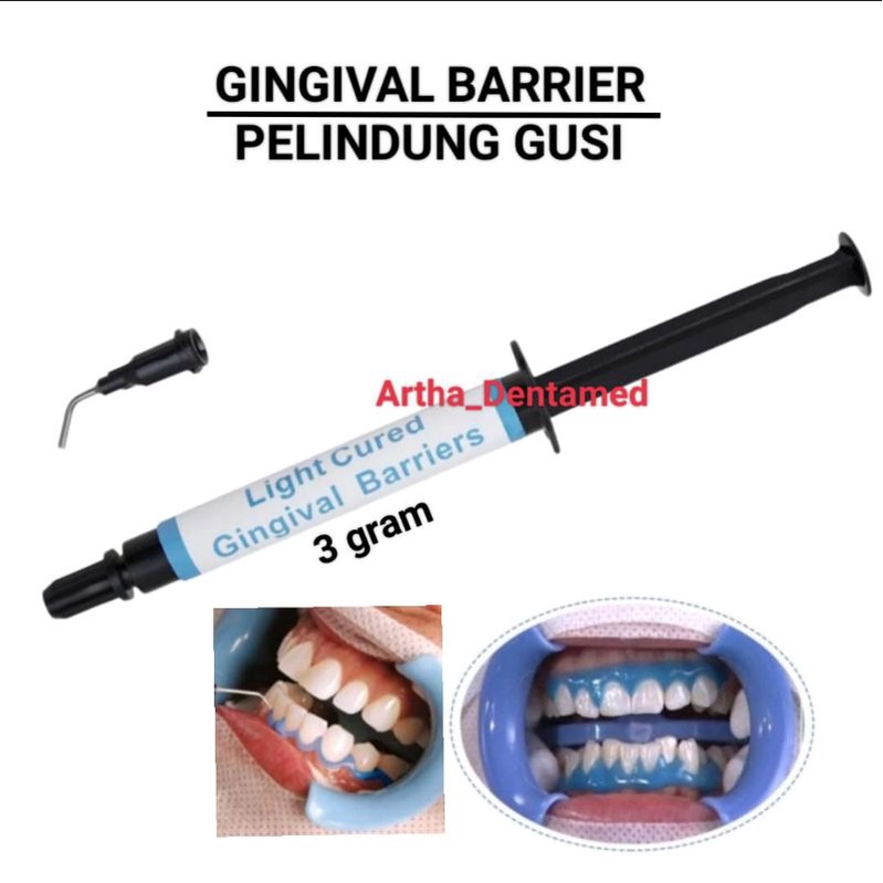GINGIVAL BARRIER / GINGIVA PROTECTOR / GUM PROTECTOR / PELINDUNG GUSI BLEACHING GIGI