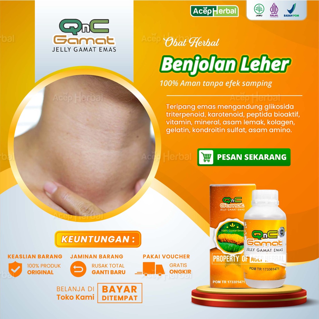 Jual Obat Oles Benjolan Di Leher Gondok Bercaun Kelenjar Getah Bening ...