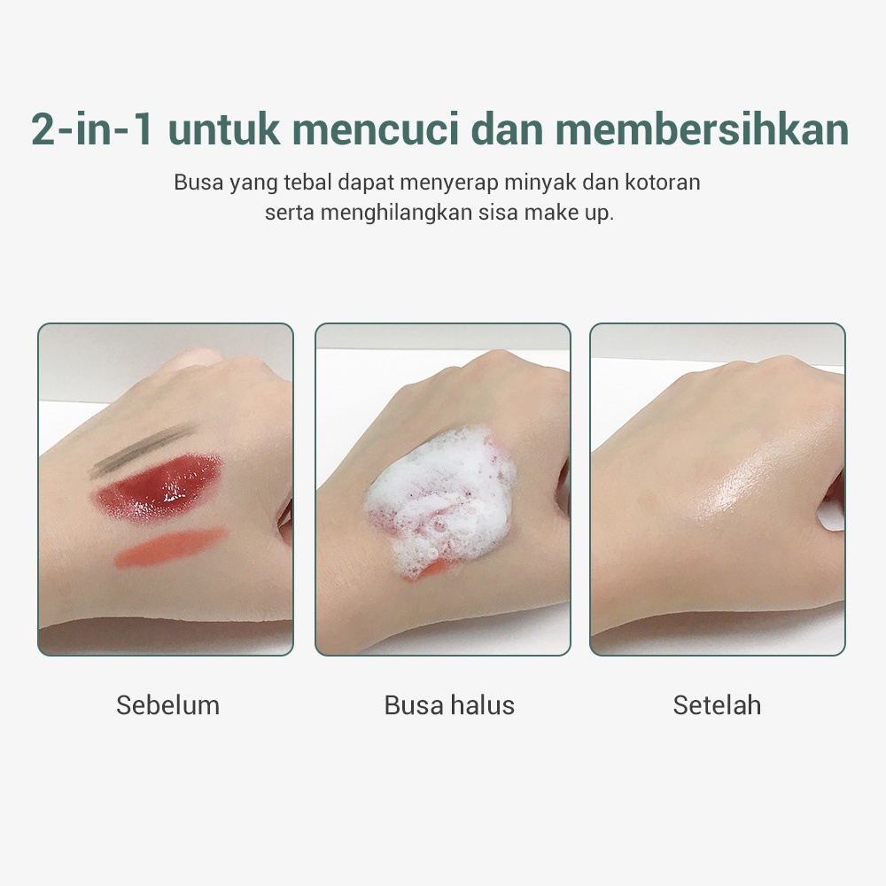 [BPOM] LANBENA Acne Facial Cleanser - Wajah Berjerawat (100 gr)