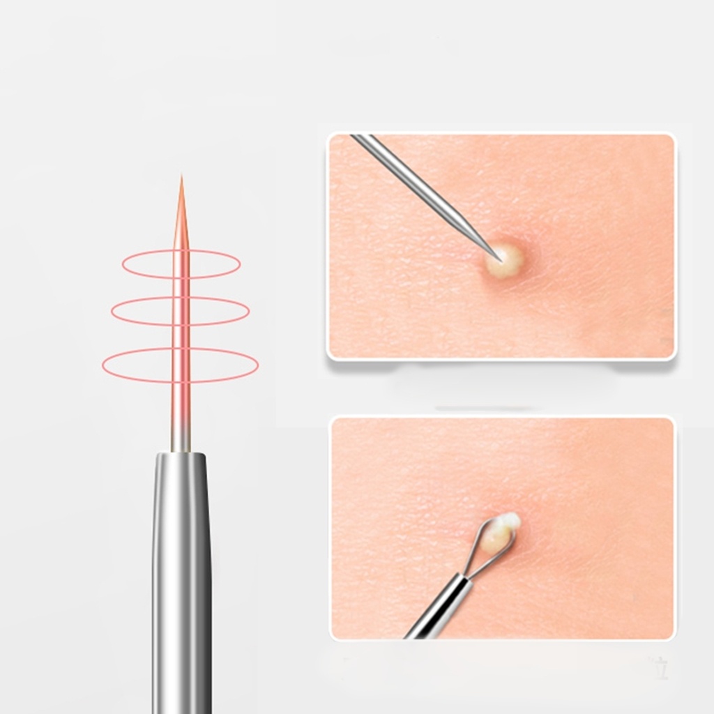 Pinset Komedo 2 in 1 / Alat Pencet Jerawat Komedo -  Jarum Penusuk Komedo Jerawat