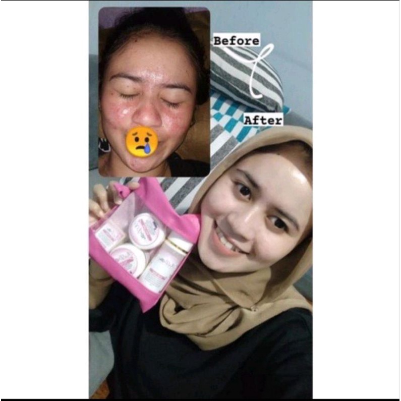 R&D GLOW Pemutiih dan pencerah wajah