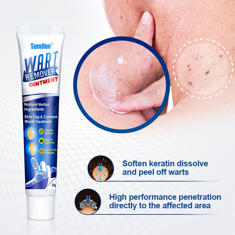 【20 gr】Skin Tag Remover Cream/Salep Obat Penghilang Tahi Lalat dan Kutil/Krim Pengilang Kutil/Wart Removal Cream