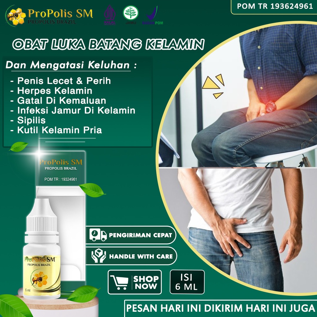 Obat Luka Batang Kelamin Pria Lecet Perih Bintik Penis Salep Gatal Pada Kemaluan Pria Infeksi Jamur 