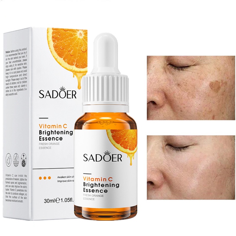 Vitamin C Face Serum Whitening Brightening Freckle Fade Dark Spot Removal Pigment Melanin Correcting Essence 30ml