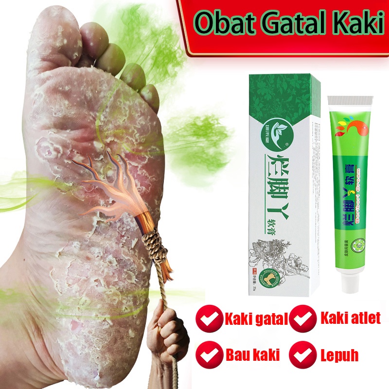 Jual Obat Gatal Kaki Obat Gatal Di Sela Jari Kaki Dan Tangan Obat Oles