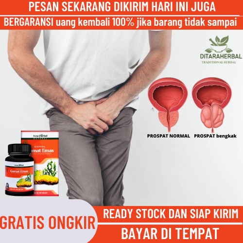 Obat Penyempitan Uretra, Obat Striktur, Obat Saluran Uretra Menyempit, Obat Kencing Terhambat, Obat 