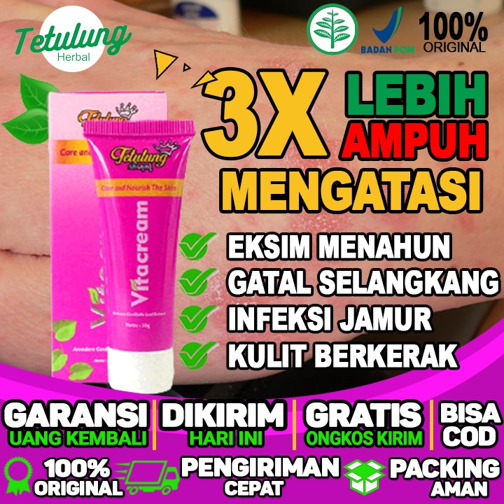 Obat Gatal Selangkangan 100% Asli Bpom Vitacream Dijamin Ampuh Menghilangkan Gatal Selangkangan