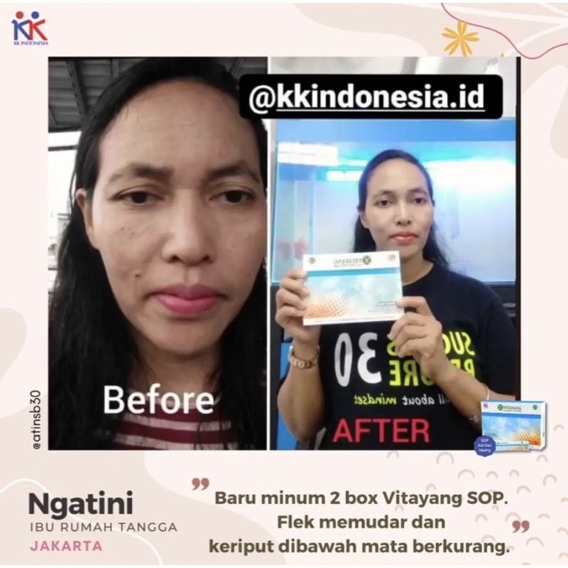 Vitayang SOP Salmon Ovary Peptide Minuman Kecantikan dari Jepan Menghilangkan Flek jerawat Mencerahkan wajah Suplemen Kesehatan Collagen Original KK Indonesia