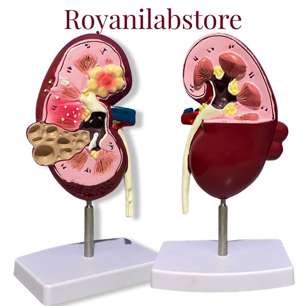 PERAGA GINJAL MANUSIA / MANEKIN ALAT PERAGA MEDICAL PATOLOGI GINJAL