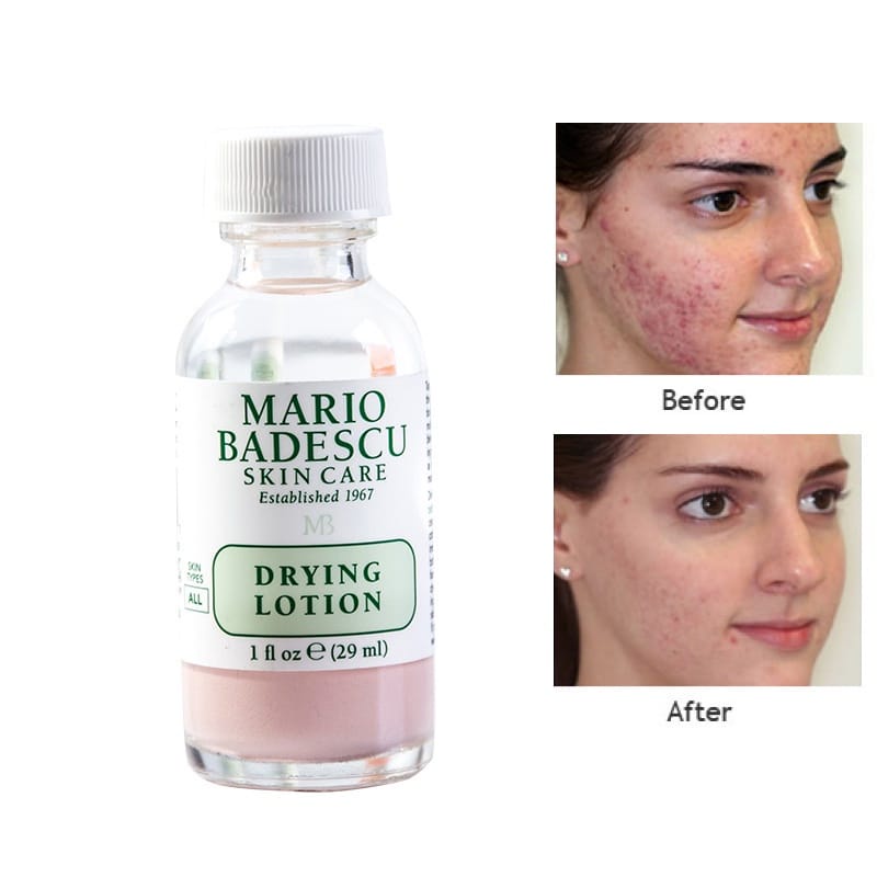 Mario Badescu Drying Lotion Perawatan Wajah Full Size 29ml