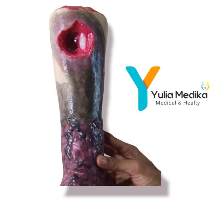 Phantom Manikin / Manekin Kaki Luka Decubitus