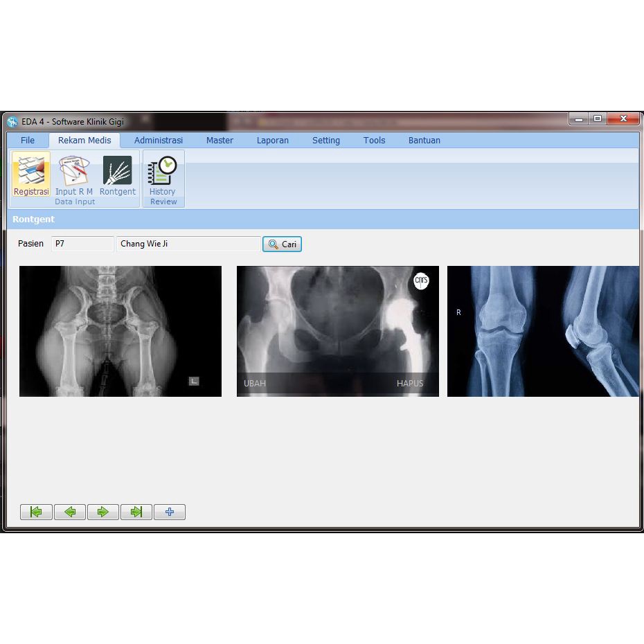 Software Klinik Gigi EDA 4.5 software untuk klinik gigi ORIGINAL