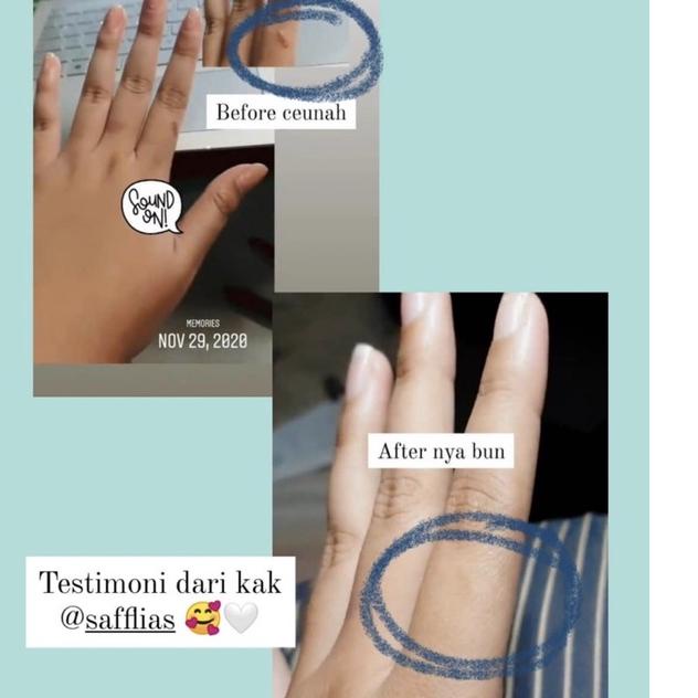 ㅘ Efyu algae bar soap - Sabun jerawat dan mencerahkan ブ