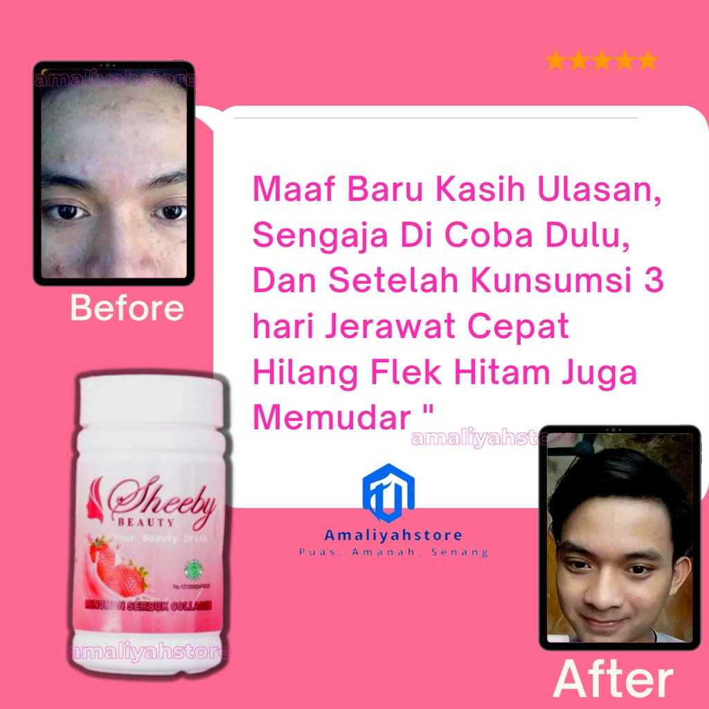 Sheeby Beauty Collagen Minuman Serbuk Shelby Sheby Beuty Drink Kolagen Suplemen Pemutih Pencerah Kulit Tubuh Badan Wajah Pria Dan Wanita  Halal Permanen Bpom