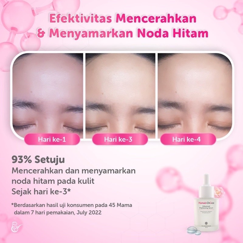 Mama Choice Serum Bright Menyamarkan Noda Hitam Flek Wajah Ibu Hamil Mencerahkan Wajah