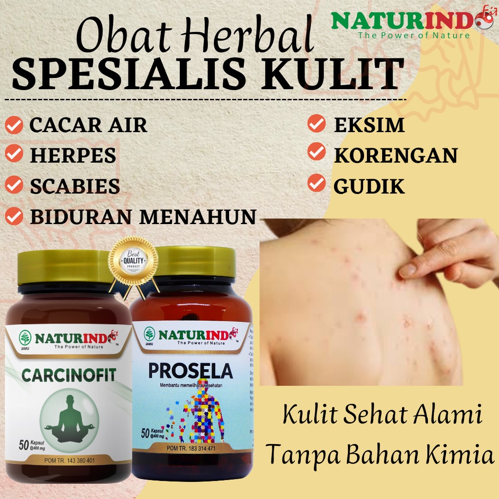 Obat Gatal Kulit Scabies Biduran Alergi Gatal Kulit Herpes Cacar Air Kulit Paling Ampuh Herbal Natur