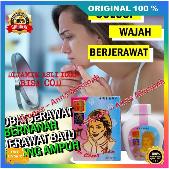 PROMO! Obat Jerawat China Obat Penghilang Jerawat dan Darah Kotor Ampuh 100% ASLI ORIGINAL