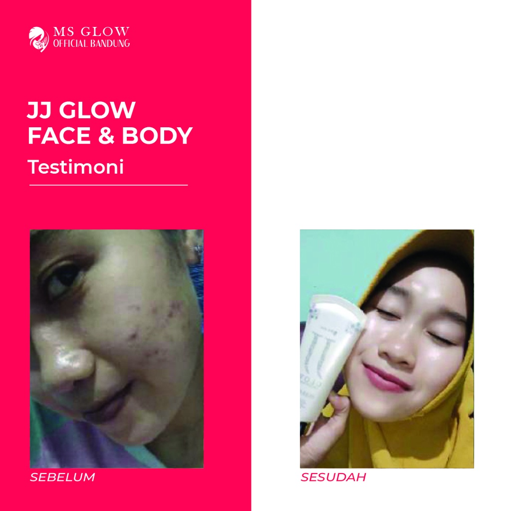 JJ Glow MS Glow Sunscreen / Sunblock Face &amp; Body Cream - By MsGlowBandung