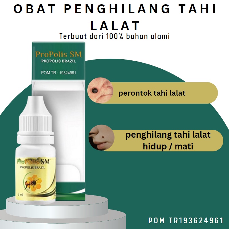 Jual Kaka Herbal Obat Tahi Lalat Obat Tahi Lalat Di Wajah Obat Tahi Lalat Tanpa Bekas Obat