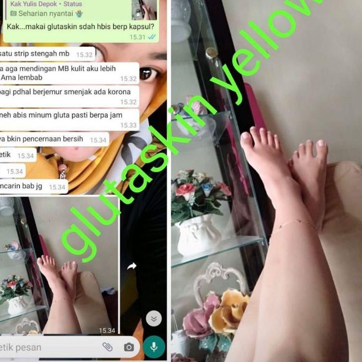 

⍐ Distributor resmi glutaskin yellow ber id card || gluta yellow vitamin dan pemutih tubuh fda thailand ↧↨