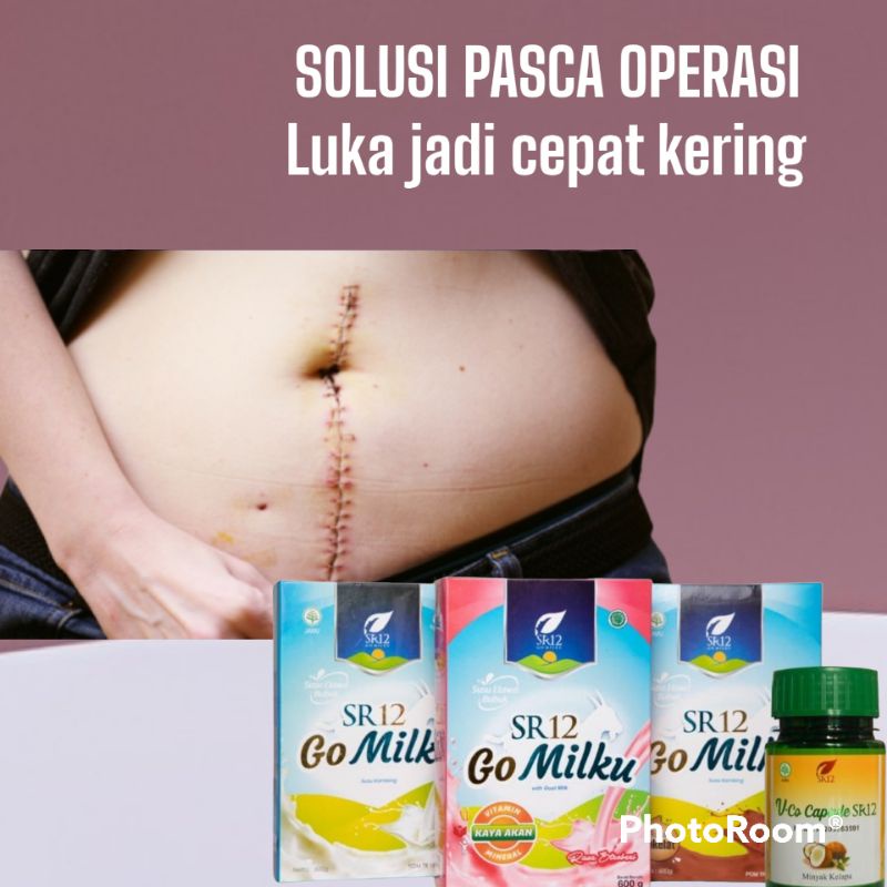 

GOMILKU SUSU SOLUSI PASCA OPERASI / SOLUSI LUKA CEPAT KERING