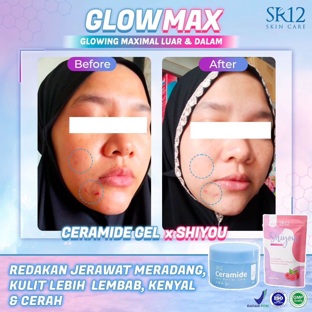 SHIYOU COLLAGEN SR12 / SHIYOU SR12 / MINUMAN KESEHATAN / MINUMAN KOLAGEN PEMUTIH KULIT / COLLAGEN DRINK BPOM